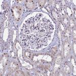 Coronin 2A Antibody in Immunohistochemistry (IHC)