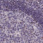 Coronin 2A Antibody in Immunohistochemistry (IHC)