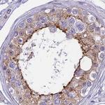 Coronin 2A Antibody in Immunohistochemistry (IHC)