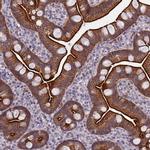 Coronin 2A Antibody in Immunohistochemistry (IHC)