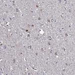 TK2 Antibody in Immunohistochemistry (Paraffin) (IHC (P))