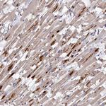 TK2 Antibody in Immunohistochemistry (Paraffin) (IHC (P))