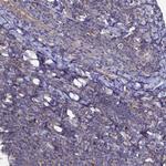 TK2 Polyclonal Antibody