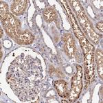 TK2 Antibody in Immunohistochemistry (IHC)