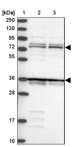 Katanin p80 Antibody in Western Blot (WB)