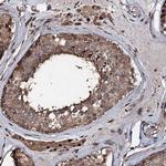 FAAP24 Antibody in Immunohistochemistry (Paraffin) (IHC (P))