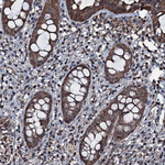 FAAP24 Antibody in Immunohistochemistry (Paraffin) (IHC (P))
