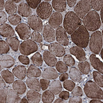 FAAP24 Antibody in Immunohistochemistry (Paraffin) (IHC (P))