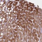 PGRMC2 Antibody in Immunohistochemistry (Paraffin) (IHC (P))