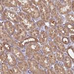 TIMM8B Polyclonal Antibody