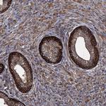TXNDC11 Antibody in Immunohistochemistry (Paraffin) (IHC (P))