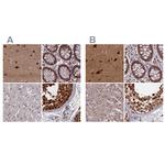 NAE1 Polyclonal Antibody