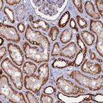 MPV17L Antibody in Immunohistochemistry (IHC)