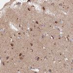 MPV17L Antibody in Immunohistochemistry (IHC)