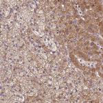 SPATA2L Antibody in Immunohistochemistry (IHC)