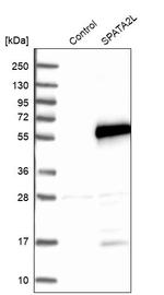 SPATA2L Antibody in Western Blot (WB)