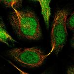 SNRNP25 Polyclonal Antibody