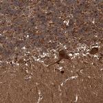 SNRNP25 Antibody in Immunohistochemistry (IHC)
