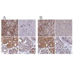 AMDHD2 Antibody in Immunohistochemistry (IHC)