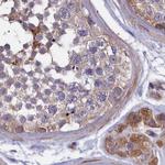 AMDHD2 Antibody in Immunohistochemistry (IHC)