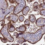 DNAJC17 Polyclonal Antibody