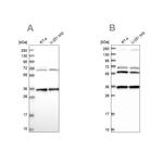 DNAJC17 Antibody in Western Blot (WB)