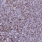 Histone H2A.X Antibody in Immunohistochemistry (IHC)