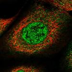 SPATA13 Antibody in Immunocytochemistry (ICC/IF)