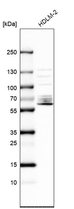 SPATA13 Antibody in Western Blot (WB)