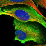 HYLS1 Polyclonal Antibody