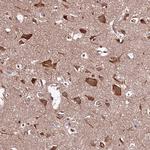 HYLS1 Antibody in Immunohistochemistry (Paraffin) (IHC (P))
