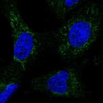 NDUFA13 Polyclonal Antibody