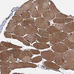 NDUFA13 Antibody in Immunohistochemistry (IHC)