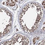 NDUFA13 Antibody in Immunohistochemistry (IHC)