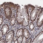 NDUFA13 Antibody in Immunohistochemistry (IHC)
