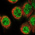 CP070 Polyclonal Antibody