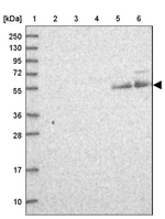 CP070 Antibody in Western Blot (WB)