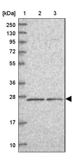 GINS3 Antibody in Western Blot (WB)