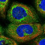 DHRS11 Polyclonal Antibody