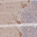 DHRS11 Antibody in Immunohistochemistry (Paraffin) (IHC (P))
