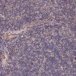 DHRS11 Antibody in Immunohistochemistry (Paraffin) (IHC (P))