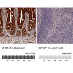 DHRS11 Antibody in Immunohistochemistry (IHC)
