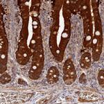 DHRS11 Antibody in Immunohistochemistry (IHC)