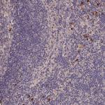 DHRS11 Antibody in Immunohistochemistry (IHC)