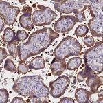 PPP1R13L Antibody in Immunohistochemistry (Paraffin) (IHC (P))