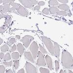 PPP1R13L Antibody in Immunohistochemistry (Paraffin) (IHC (P))