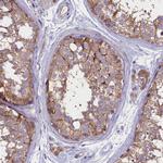 PPP1R13L Antibody in Immunohistochemistry (Paraffin) (IHC (P))