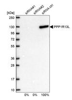 PPP1R13L Antibody