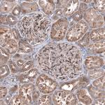 ZSWIM8 Antibody in Immunohistochemistry (Paraffin) (IHC (P))