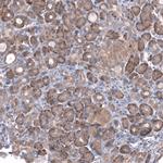 ZSWIM8 Antibody in Immunohistochemistry (Paraffin) (IHC (P))